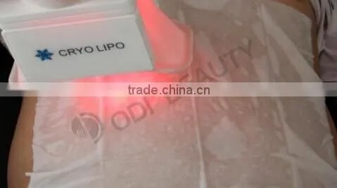 OD-C100 OEM Body Weight Loss Fat Freezing Belly Fat Loss Slimming Equipment photo-5