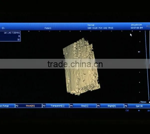 CE Approved Laptop PC Platform 3D Image Ultrasound Machine/Scanner With 3.5Mhz Convex Probe photo-4