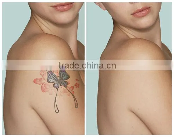 Advanced Technology Portable Multifunction Laser Tatoo Removal Machine photo-6