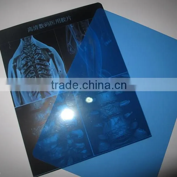 Hot Blue Film Free Blue Thermal Film Medical(12*14) X-ray Blue Film photo-2