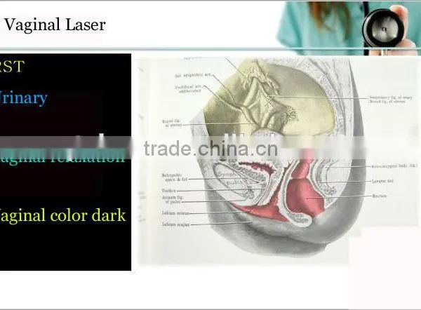 2015 Hot Sale Imported RF Tube Co2 Fractional Laser for Vaginal Treatment photo-4