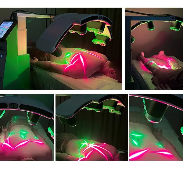 Top Sales 532nm Green Light 635 Red Light Therapy Laser Machine10d Maxlipo Master System Lipolaser for Body Shape Slimming photo-6
