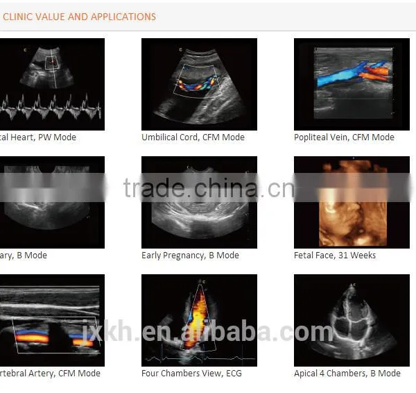 3D Trolley Ultrasound Scanner Color Doppler Ultrasound System (optional 4D) photo-6