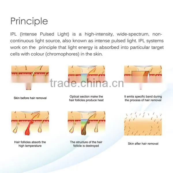 SMQ-NK Portable OPT Shr Hair Removal Machine / IPL / OPT SHR photo-4