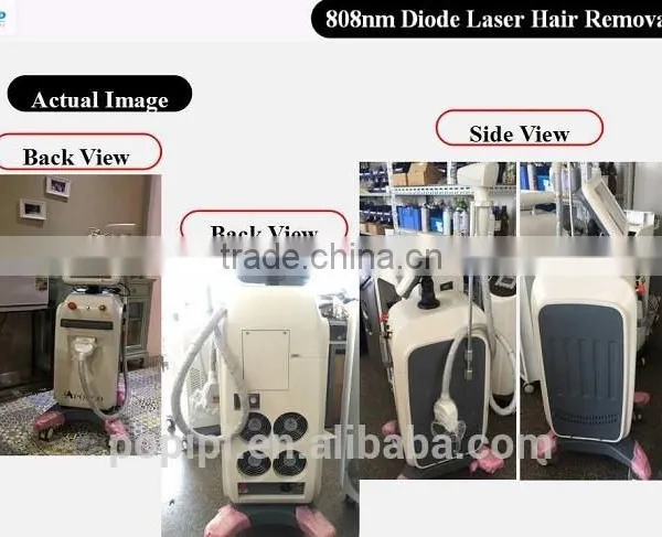 POP DL7 808 nm Diode Laser Hair Removal Machine Medical Salon Use ce Approval photo-5