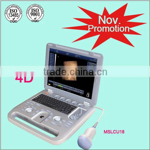 (MSLCU18)3D 4D Handheld Color Doppler Medical Ultrasound Scan Machine