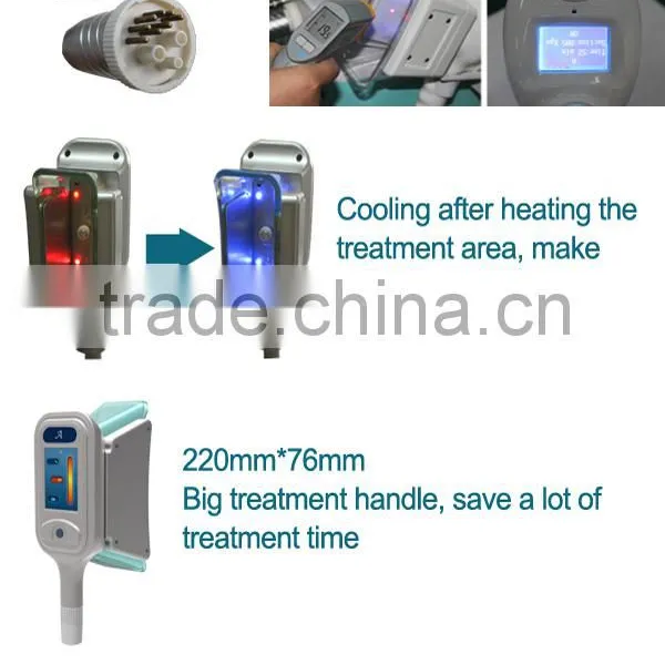 2014 Unparalleled Bottom Price 2 Cryolipolysis Hand Lose Weight Pieces Vertical Cryolipolysis Body Shape Beauty Machine Fat Reduction photo-4