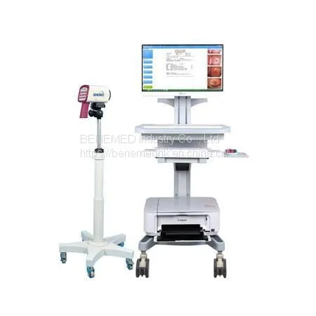 Medical Equipment Digital Video Colposcope for Gynecology photo-2