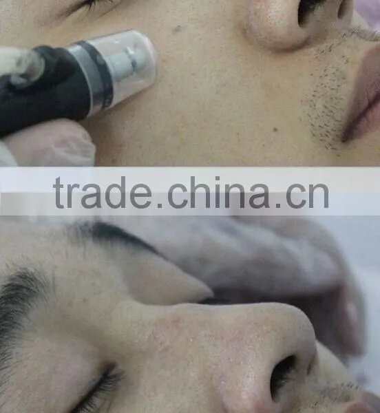 Multifunction Facial Cleaning Brush Microdermabrasion Skin Jet Peel Machine photo-5