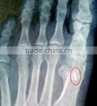 China KND-A/F CE Medical Dry Film Agfa Healthcare photo-3