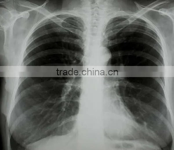 China CXR Film KND-A/F CE