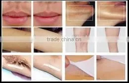 Professional Factory Supply Hair Removal Machine Best Price 808 Diode Laser Hair Removal photo-6