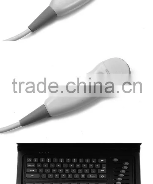 High Quality 10.4-inch High-resolution TFT LCD Display Black Color Portable Laptop Ultrasound Machine for Sale photo-2