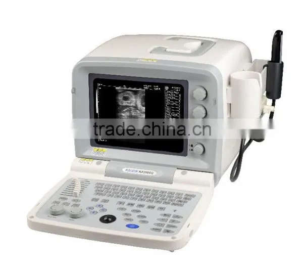 Hot Sale Cheap And Best Seller Portable Ultrasound Machine 2000G photo-2