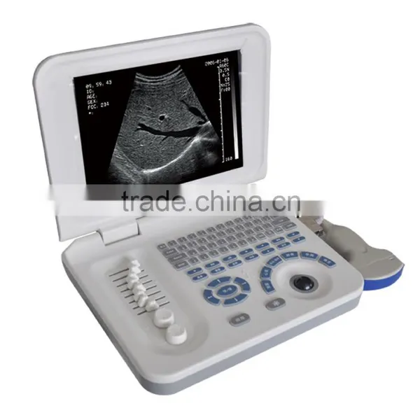 Ultrasound Equipments & Laptop Ultrasonic Machine 3018 photo-5