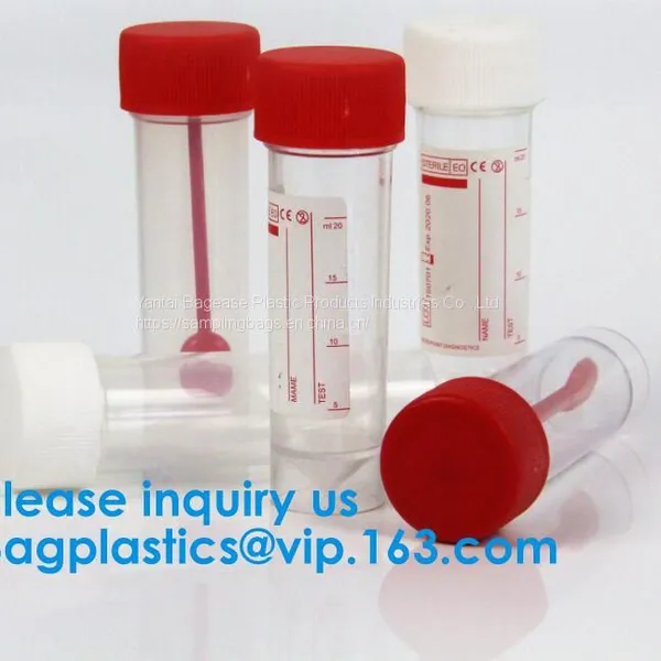 20ml-1000ml Histology Specimen Container Urine Containers, Disposable Medical Consumables Plastic 100ml 120ml Sampling Cup Specimen Container photo-5