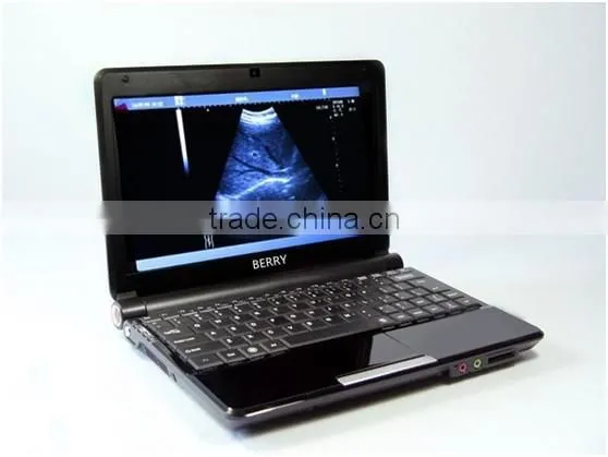 Health&Medical Equipment B/W Portable Ultrasound Scanner photo-2