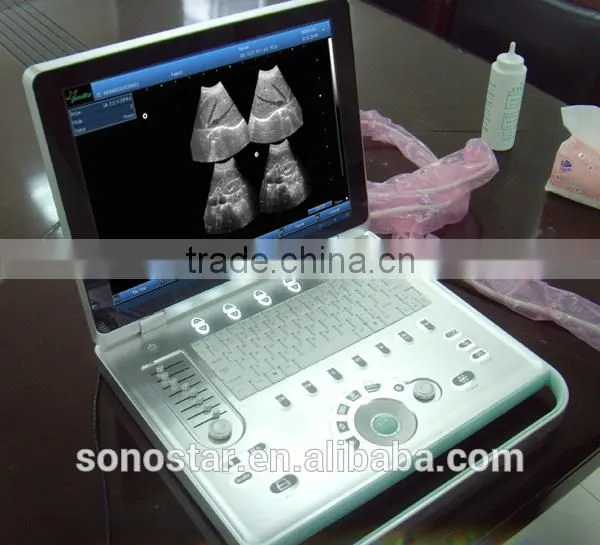 SS-9 PC Based Laptop Ultrasound B Scanner photo-4