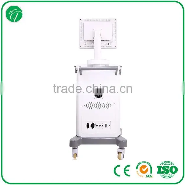 Trolley Ultrasound Scanner / Ultrasound 3018II photo-4