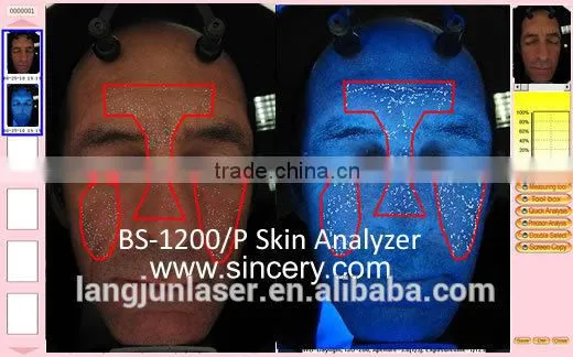 Body Slimming Equipment Tracking Treatment Machine 3D Skin Analyzer photo-3