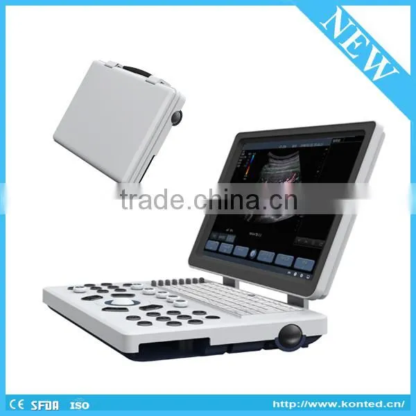 Portable Echography Machine/4D Laptop Ultrasound Scanner photo-2