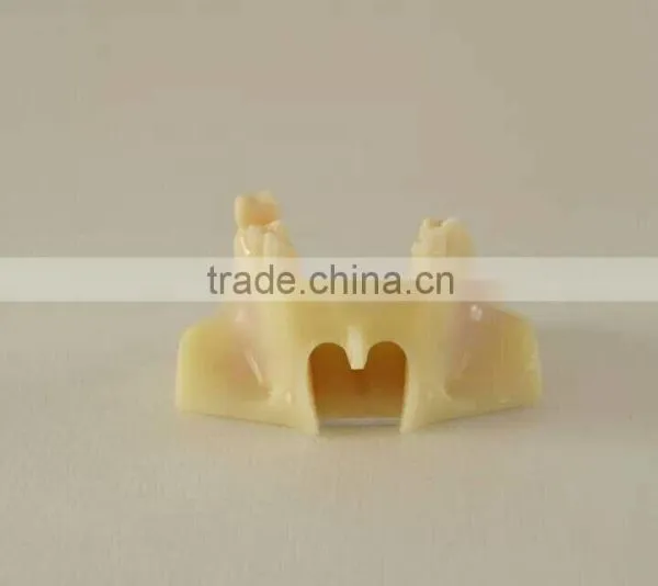 Dental Teaching Model,Human Dental Teaching Models,Dental Implant Model photo-2