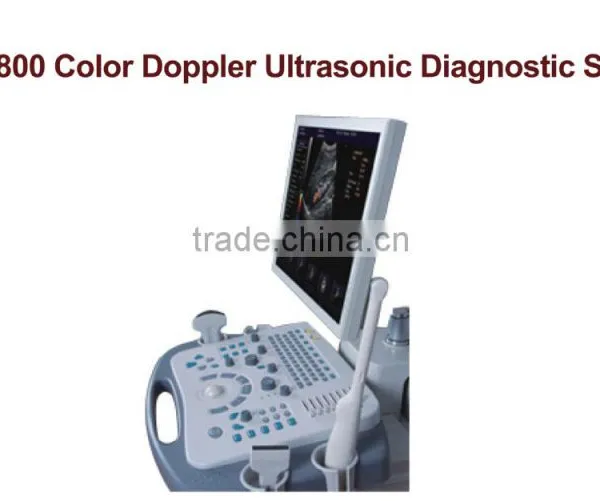 Top Grade Hotsale Link Digital Non-Interlaced Portable Ultrasound Scanner 200D With Low Price photo-3
