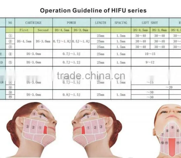 New Type HIFU-2S Face Lifting Machine/Wrinkle Remover Machine/Fat Loss Machine photo-5