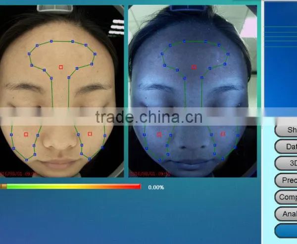 Computer Software Skin Analysis System Acne Wrinkle Spot Pore Analyzer Device photo-4