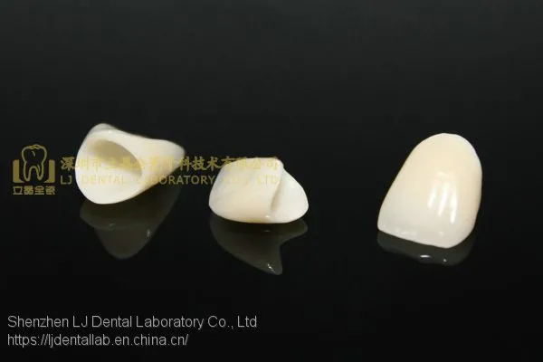 Dental Crown E.Max Ceramic, Porcelain Crown, Dental Veneers, Laboratoire Dentaire, Dentallabor, Laboratorio Dental, Dental Laboratory, Shenzhen LJ Dental Lab China photo-3