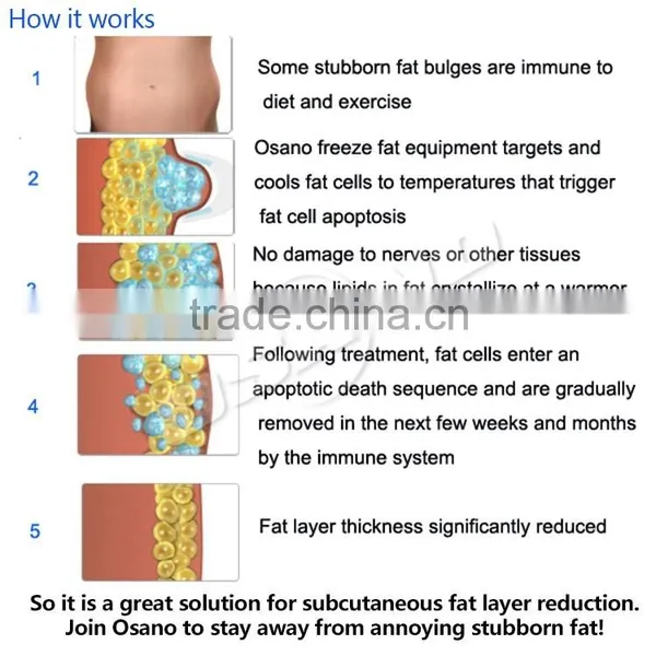 LM-S600P Cool Tech Fat Freezing Machine Cryo Slimming Liposuction Machine photo-5