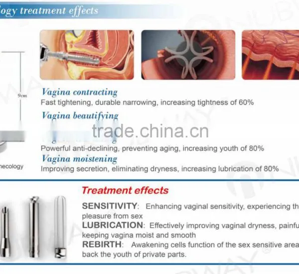 Stretch Mark Removal Vertical 40W Medical CE Approved RF Pipe Fractional Acne 515-1200nm Scar Removal Co2 Laser Pigment Removal Gynecology Treatment Laser Equipment Pigment Removal photo-6