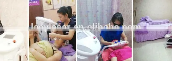 IPL SHR Hair Removal Machine for Sale photo-2