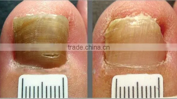 Multi-functional Wrinkle Removal and Body Care Spa Salon Equipment photo-6