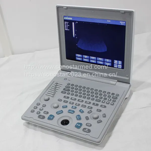 SS-6B Laptop All-Digital Ultrasound
