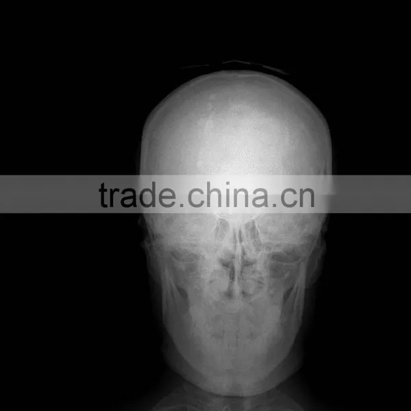 Ccd Flat Panel X-ray Detector 14x17 photo-6