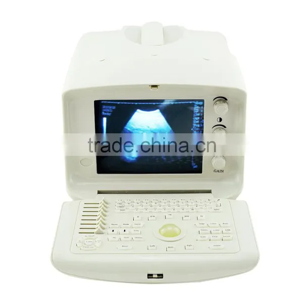 2016 Hot Sale Best Quality CE Approved Digital Portable Style Ultrasound Machine/Scanner For Sale With Cheap Price-Shelly photo-4