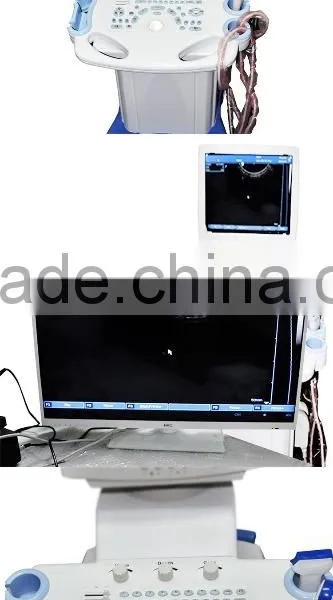 Digital Ultrasonic Diagnostic Imaging System Trolley Ultrasound Scanner for Medical photo-4