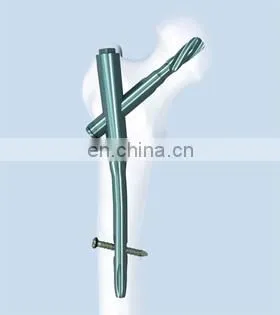 Orthopedic Trauma Implants PFNA photo-4