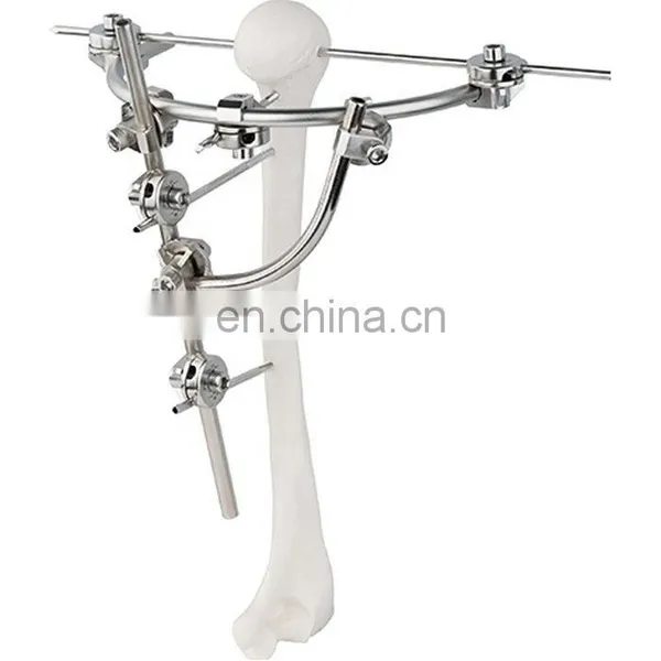 Guaranteed Quality Semi-circular External Fixator Orthopedic Surgical Implant photo-6