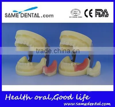 Dental Implant Practice Model DEA-31 Teeth Implant Models photo-4