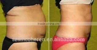 Sincoheren Coolplas Kryolipoplyse Body Massage Equipment and Cooling Machine photo-6