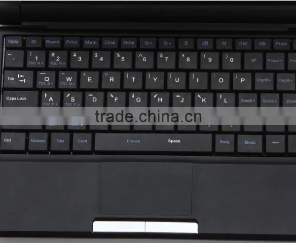 3D Workstaion 10 Inch Laptop Ultrasound Scanner RUS-9000F With 3.5Mhz Convex Probe by CE ISO Approved photo-5