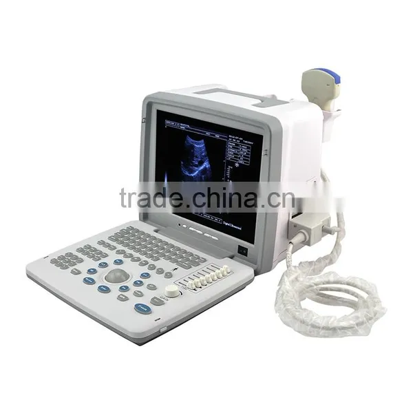 China Making 2016 High Performance Low Price Portable Mini Ultrasound Machine for Sale photo-2