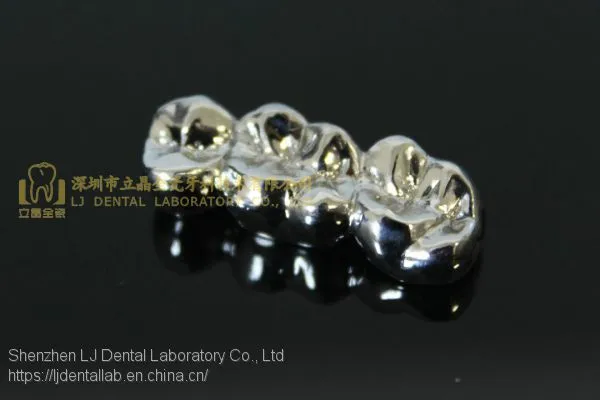 Full Metal Crown, FMC, FGC, Full Metal Post Core, Dental Crown, Cast Metal Crown, Dental Prosthesis, Laboratorio Dental, Dental Laboratory, Dentallabor, LJ Dental Lab China