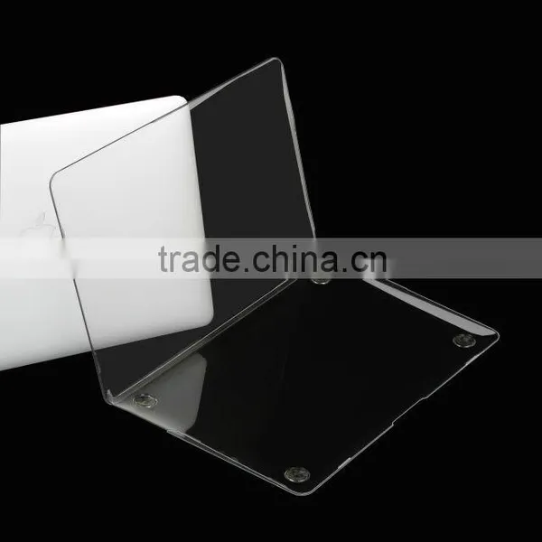 Custom Pattern Hard Cases for Macbook Pro 13 Inch