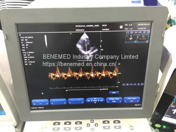Echo Color Doppler Ultrasound Scanner Bene-5 photo-4