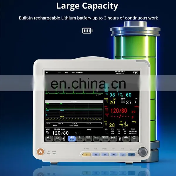 Vet Medical Monitor With ECG Waveforms Display for Vet Hospital photo-4