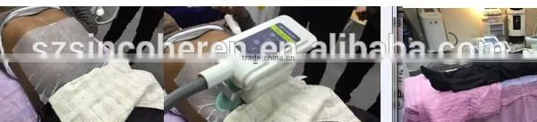 3 Cryo Handle Cryotherapy Cool Tech Liposuction Fat Freezing Machine photo-5