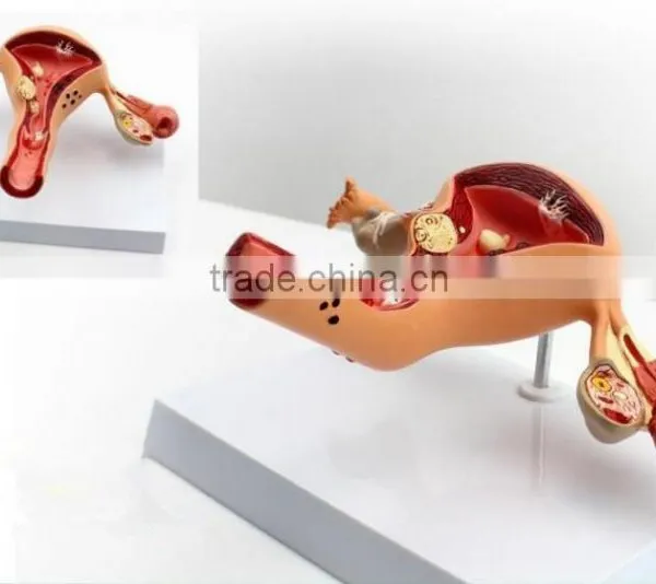 Human Uterus and Ovary Vaginal Pathological Changes Model of Reproductive Department of Gynecology Medical Demonstration Model photo-6